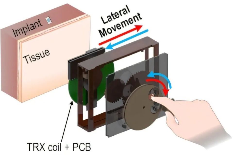 以色列医疗设备有哪些追问weekly ｜ 过去一周，脑科学领域有哪些新发现？Vol.63_https://www.jmylbn.com_新闻资讯_第40张
