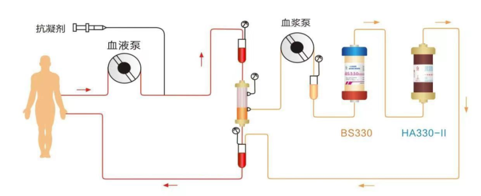 MARS人工肝图片