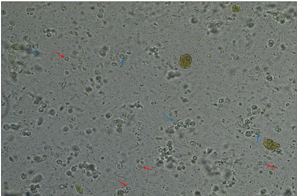 粪便常规仪器怎么用粪便中的繁星点点_https://www.jmylbn.com_新闻资讯_第2张