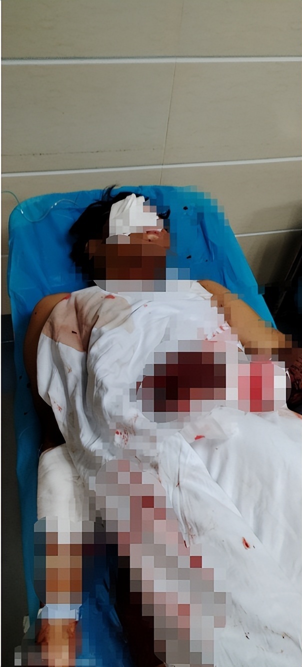 疑因情感纠纷湖南男子深夜在女友哥哥家纵火砍人