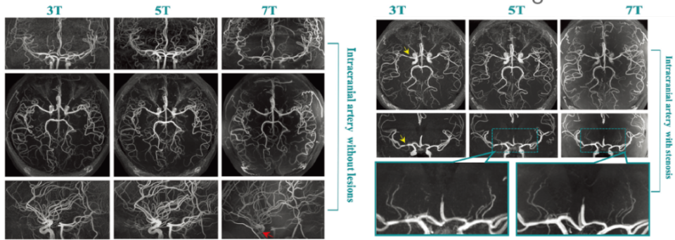 骨盆手术器械有哪些2023十大自主创新医疗器械产品_https://www.jmylbn.com_新闻资讯_第4张