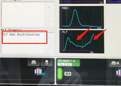 血小板卫星现象图片图片