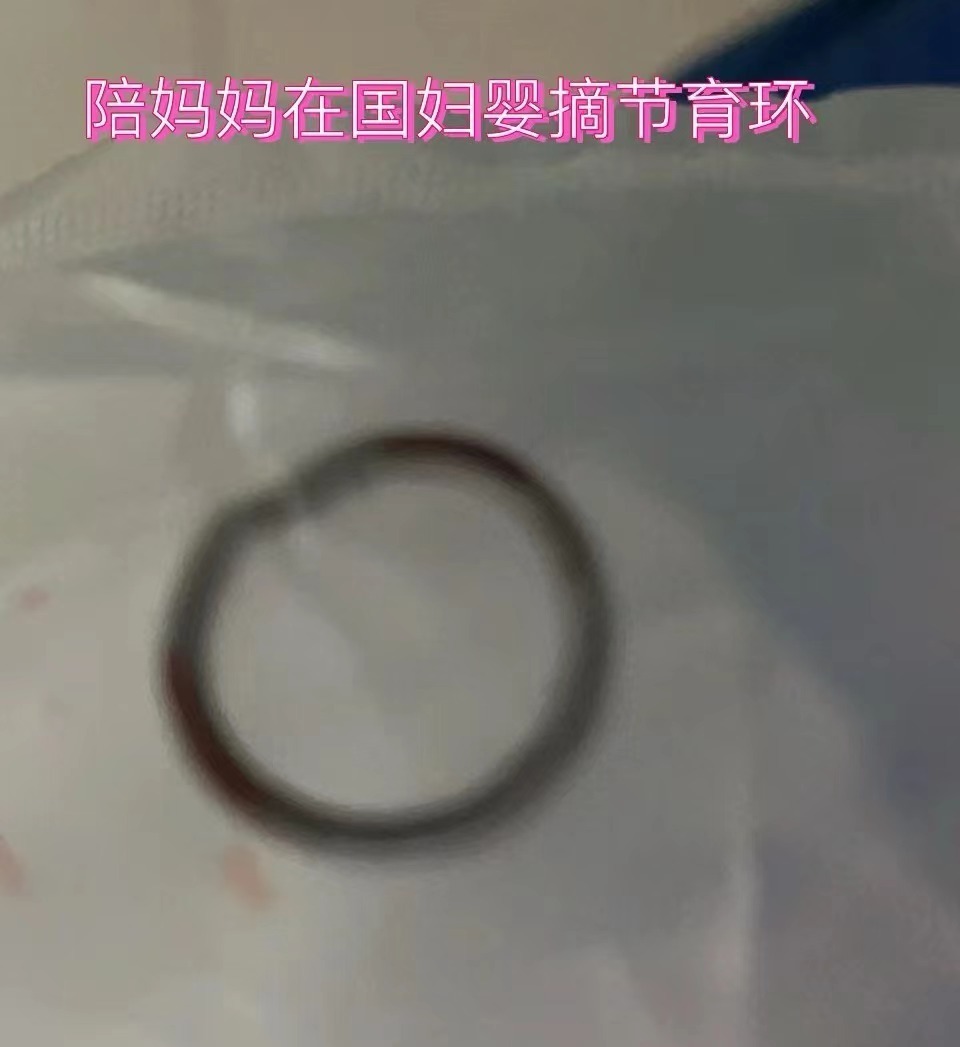 金属环节育器图片