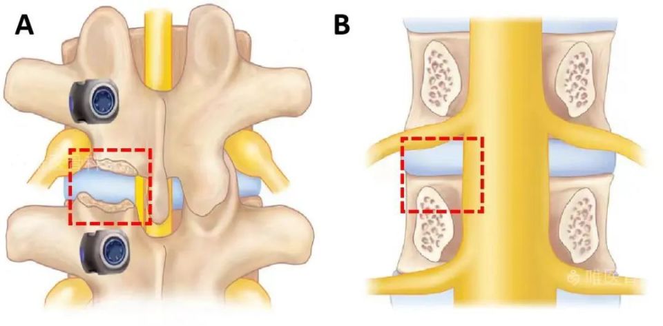 全球首个活性骨,取得fda突破性设备称号