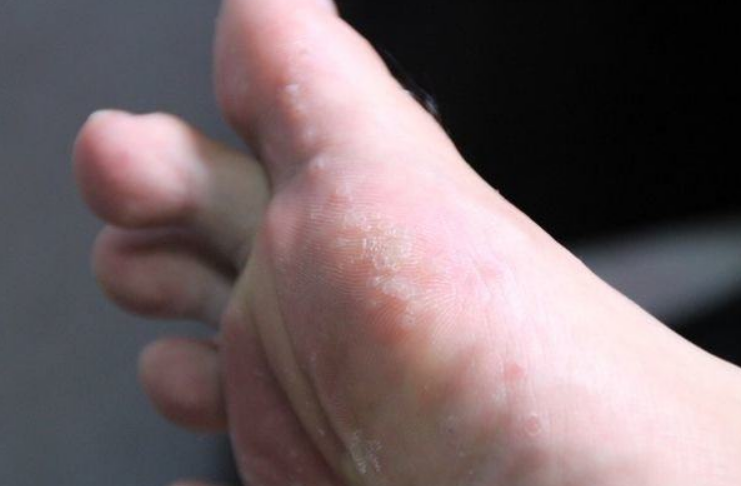 医生郑重提醒:别乱吃这3种维生素