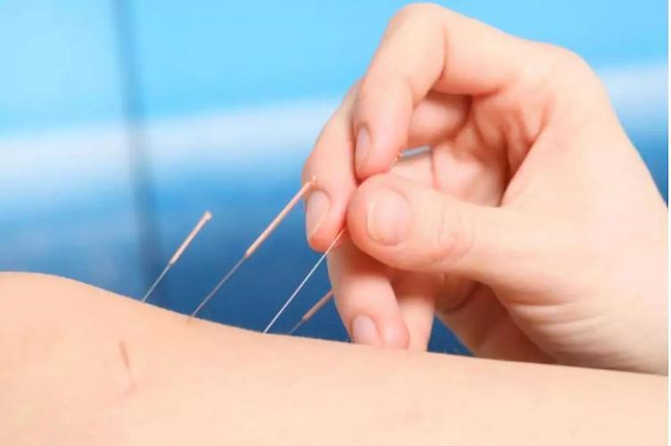 针灸对治疗慢性胆囊炎有什么作用?不同留针时间对其有什么影响?