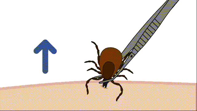 已到蜱虫活跃期请收下这份防蜱攻略