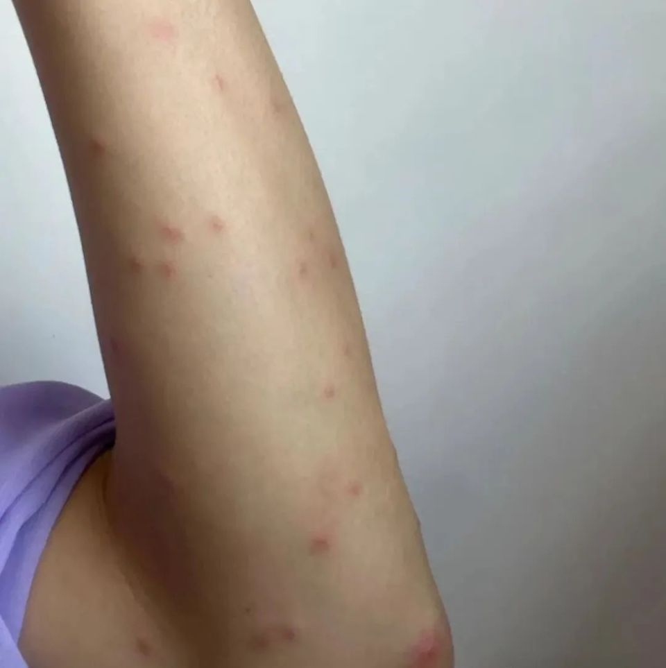 等凉席干了,收之前再用手或衣架拍一拍,螨虫尸体就会掉落;若出现席子