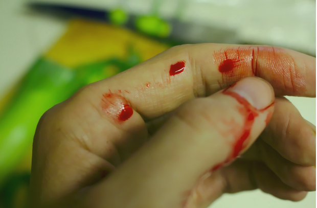 创伤胶有哪些10秒内瞬息止血！外伤“大出血”救命凝胶获批_https://www.jmylbn.com_新闻资讯_第1张