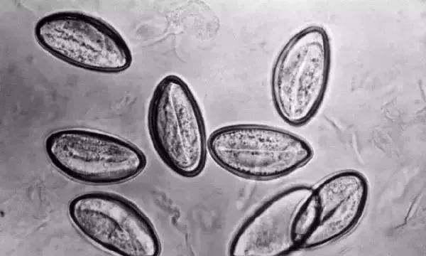 蛲虫(enterobiasis vermicularis)蛲虫会在晚上从肛门里出来,并在