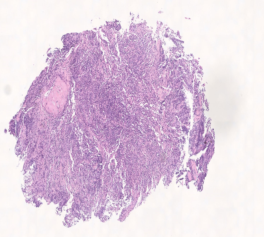 2 mg/l,红细胞沉降率为10.