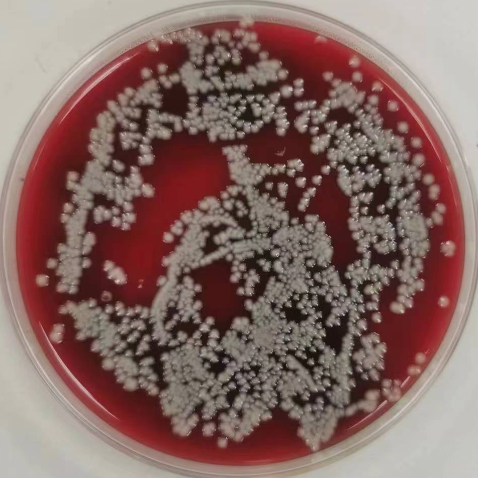 纹带棒状杆菌感染菌血症报告1例并文献分析