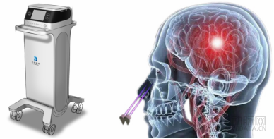 什么是等离子治疗仪北卓医疗：构筑“一体两翼”跨模态智联闭环生态，占据中国神经科学数智化浪潮先发身位_https://www.jmylbn.com_新闻资讯_第8张