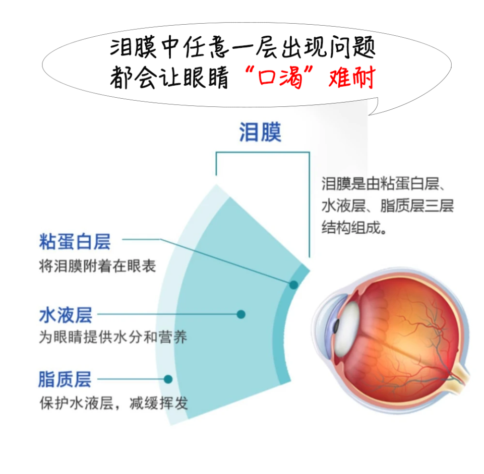 六步给眼睛敷上泪膜,告别干眼症!