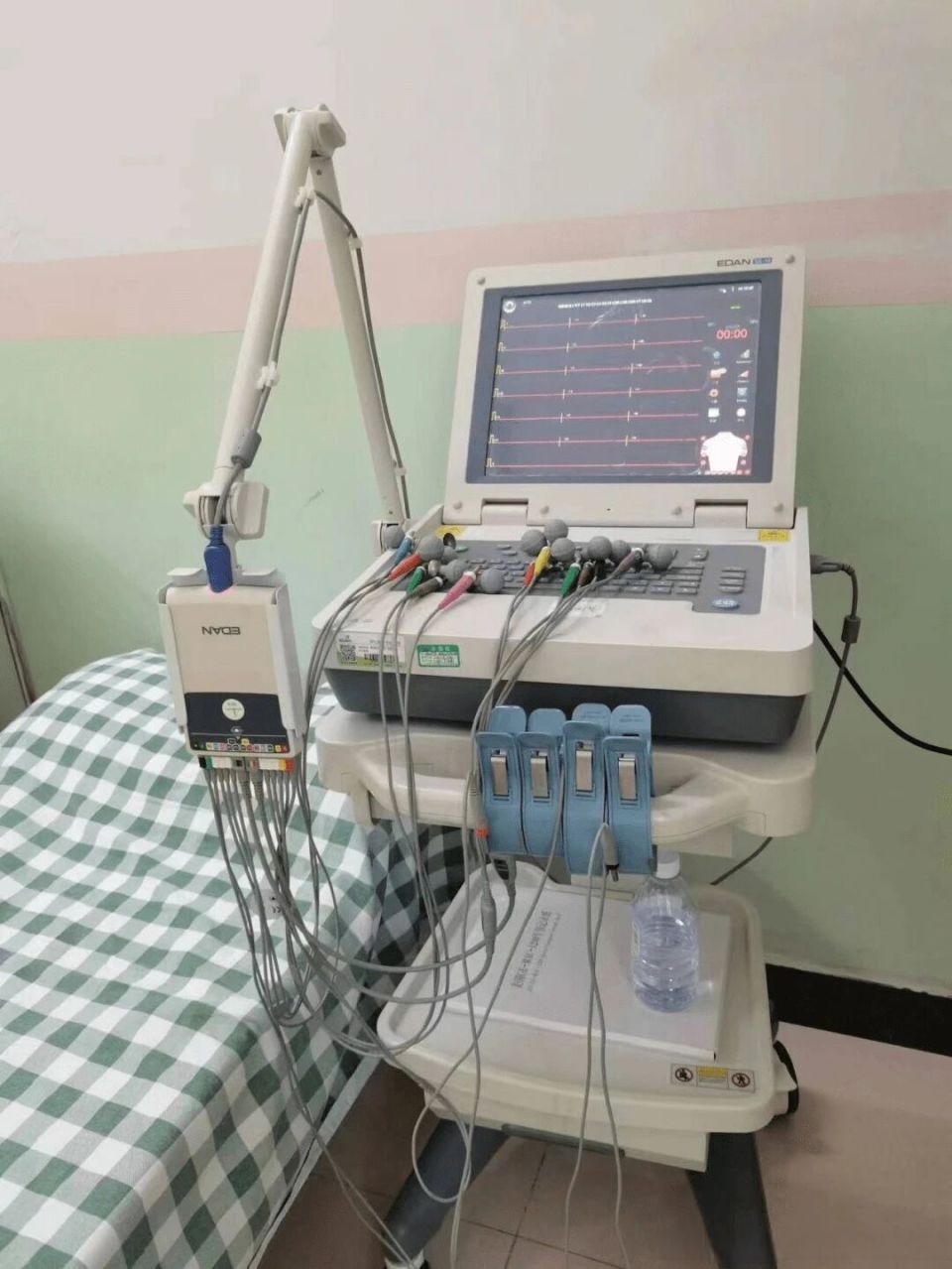 心电图机怎么维护别等“系统报错”才想起维护：一份写给当代打工人的心脏运维指南_https://www.jmylbn.com_新闻资讯_第6张