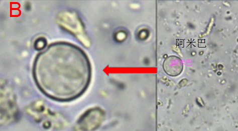 迪斯帕内阿米巴