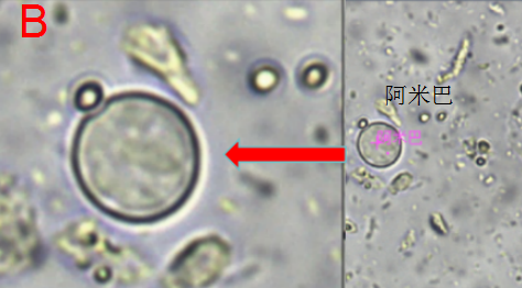 大便镜检寄生虫图片