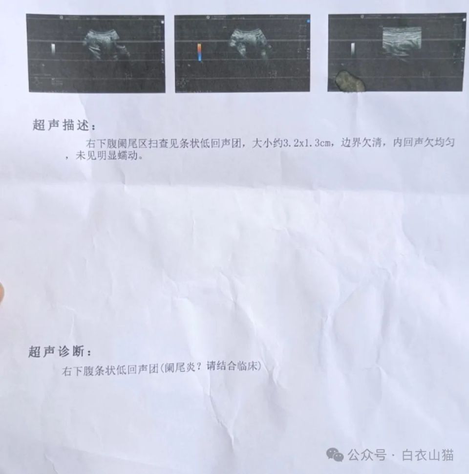 为了拯救一条阑尾我破例见了一个女网友