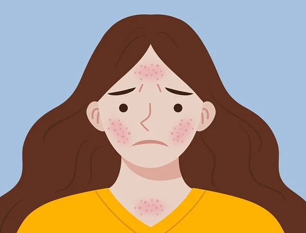 养猫需谨慎,一不小心染上这个藓……_腾讯新闻