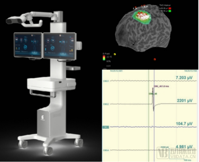 什么是等离子治疗仪北卓医疗：构筑“一体两翼”跨模态智联闭环生态，占据中国神经科学数智化浪潮先发身位_https://www.jmylbn.com_新闻资讯_第6张