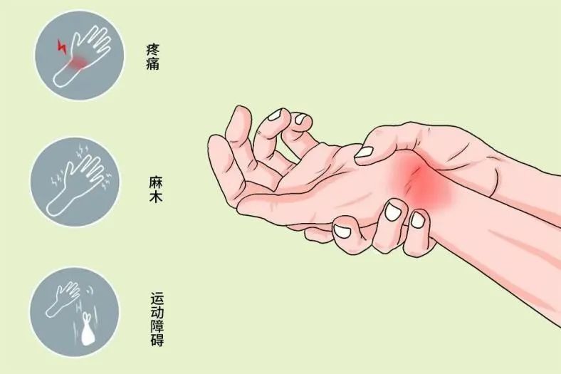 健康科普假期放松身心了解腕管综合征