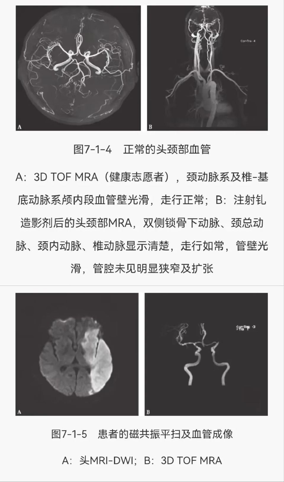 额极动脉图片