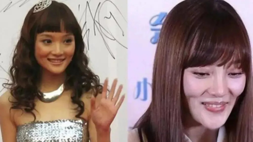 5位整容失败的女明星:蛇精脸,猪鼻头,面容僵,最后一位最惨