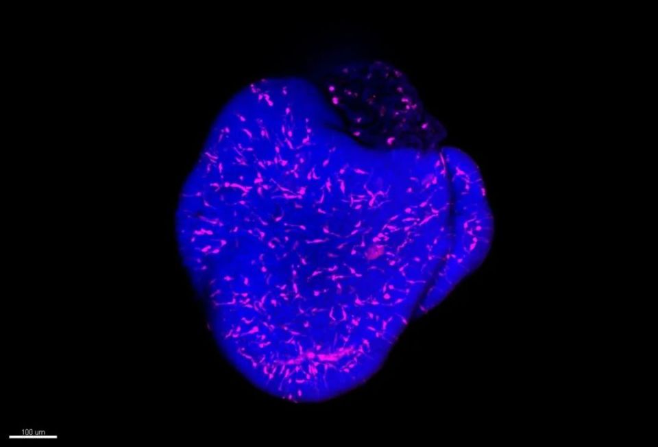 心电图机器怎么看追问weekly ｜ 过去一周，脑科学领域有哪些新发现？_https://www.jmylbn.com_新闻资讯_第25张