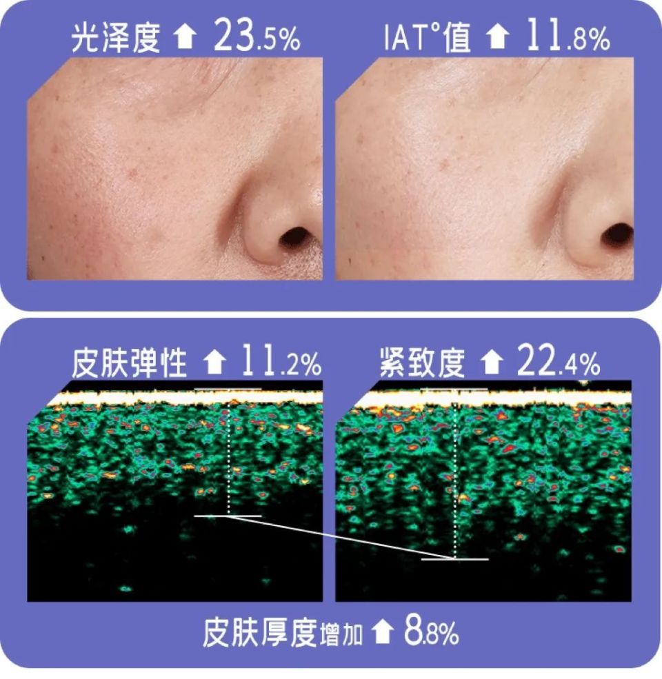 不想一个夏天老三岁,这件事就要早做(不是防晒