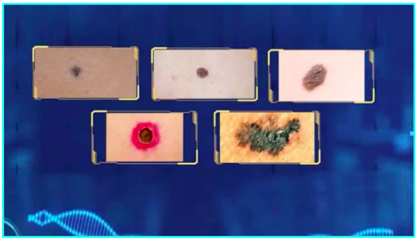 这种病极度凶险,死亡率高!5个方法快速自查_腾讯新闻