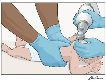 纱布为什么能止血这12种常见意外你会处理吗？收藏这份居家“救命”手册_https://www.jmylbn.com_新闻资讯_第4张