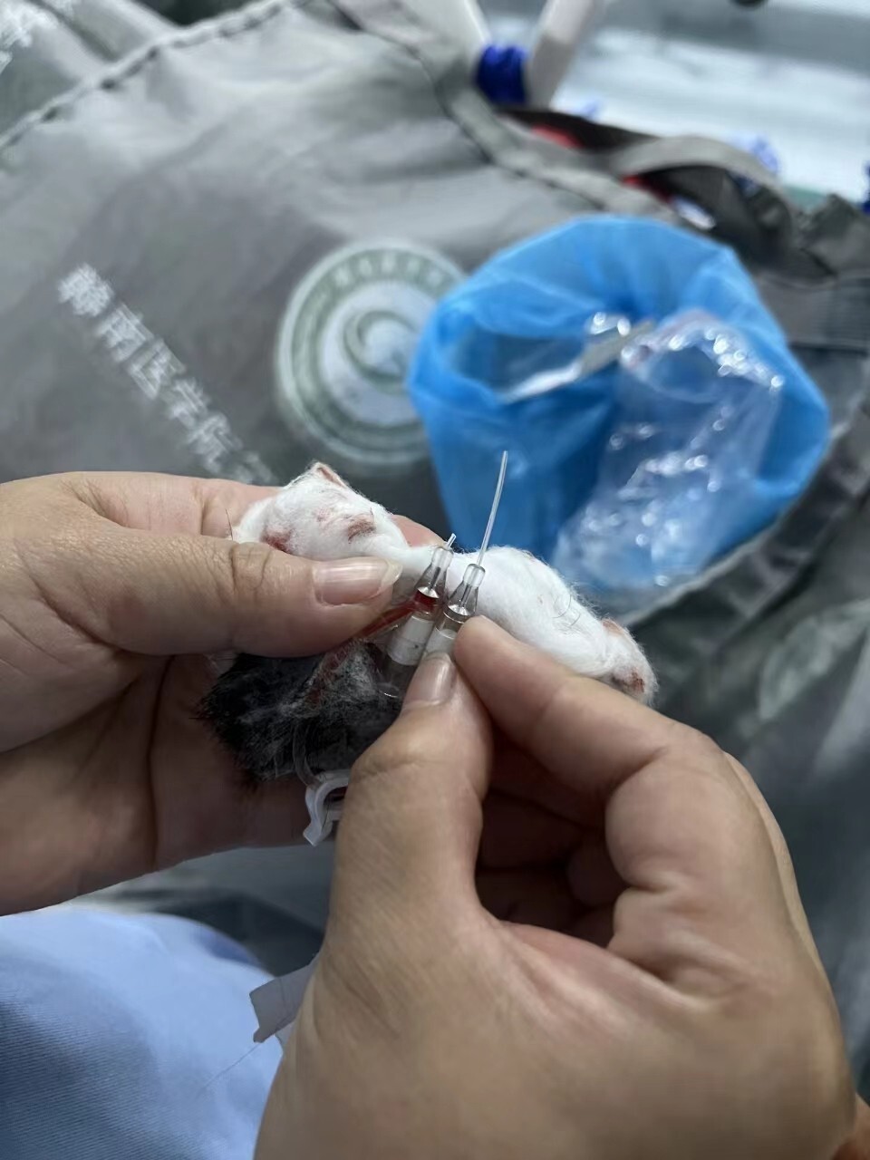 人间丨留置针软管留患儿体内5年后终取出:多位孩子家长讲述相同经历