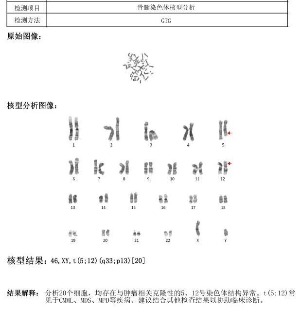 犹抱琵琶半遮面——1例嗜酸性粒细胞比例略增高的病因分析