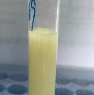 腹水听得多了,胸水又是什么?