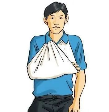 石膏托固定,三角巾悬吊于胸前即可