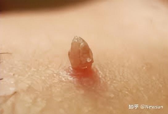 会是癌吗?答案在这里_腾讯新闻