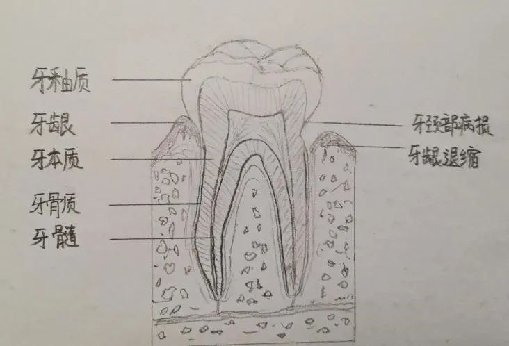 牙齿标记方法示意图图片