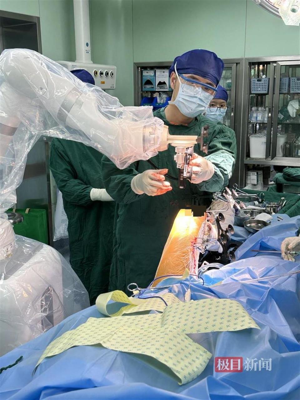 国产机器人辅助,武汉协和医院完成膝关节外侧单髁置换手术