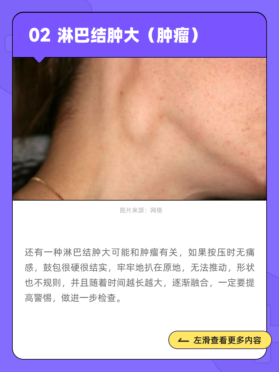 耳朵后面长了「包」,到底是什么?