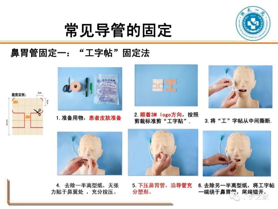正确的导管位置图