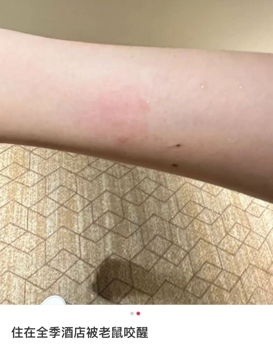 长沙一女子入住南昌全季酒店半夜被老鼠咬醒,投诉人:酒店提出赔偿5000