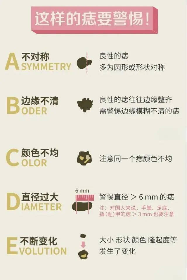身上的黑痣,什么情况需要治疗?