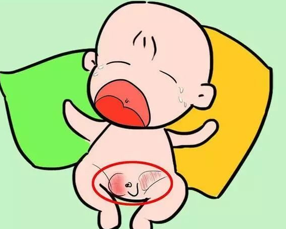 接下来的几天,李奶奶又在小孙子排便后,跑跳后发现了这个鼓包,特别是