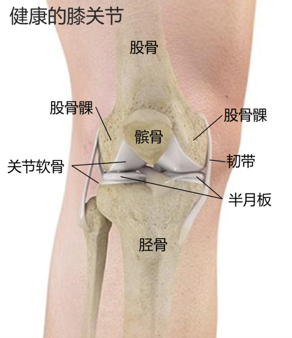 骨性结构形成膝关节的基本框架,包括股骨髁(大腿骨下端),胫骨(小腿骨)