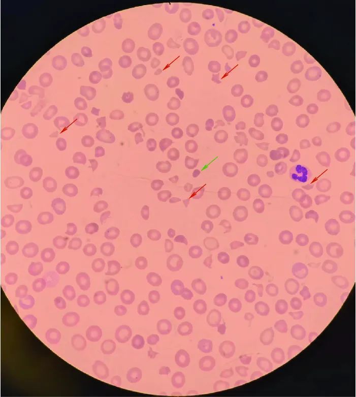 检验人也可以是"鬼门关"的把关人