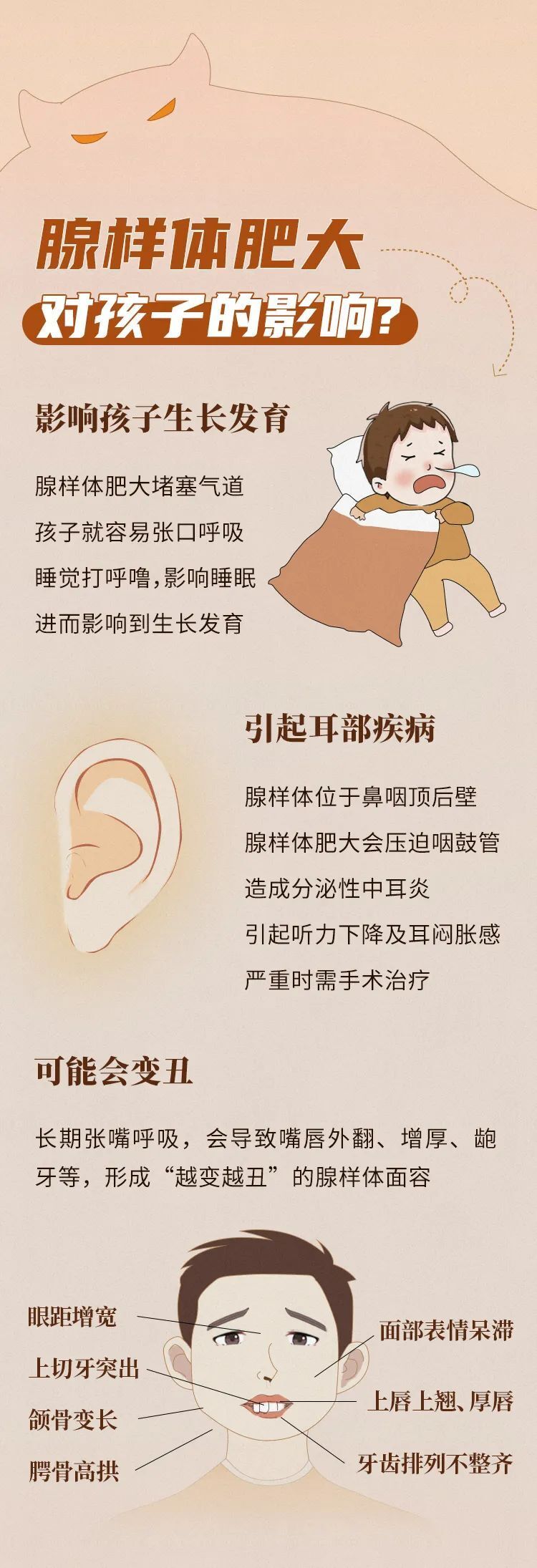 健康科普丨一图了解腺样体肥大_腾讯新闻