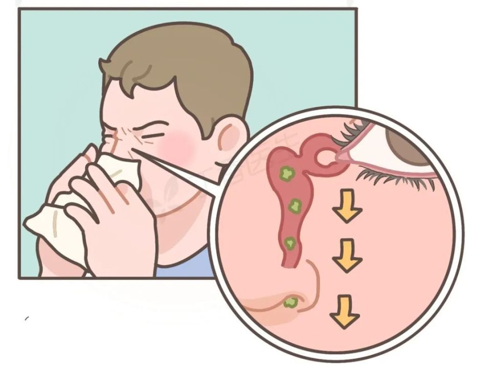 灰尘,睫毛……进到眼睛里的异物,去哪儿了?