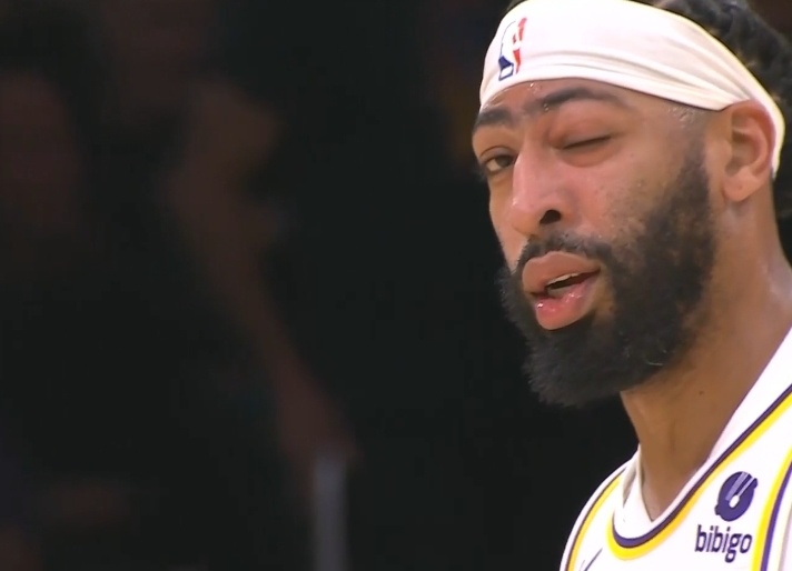 浓眉医生说我不需要戴护目镜来保护眼睛因此我选择不戴