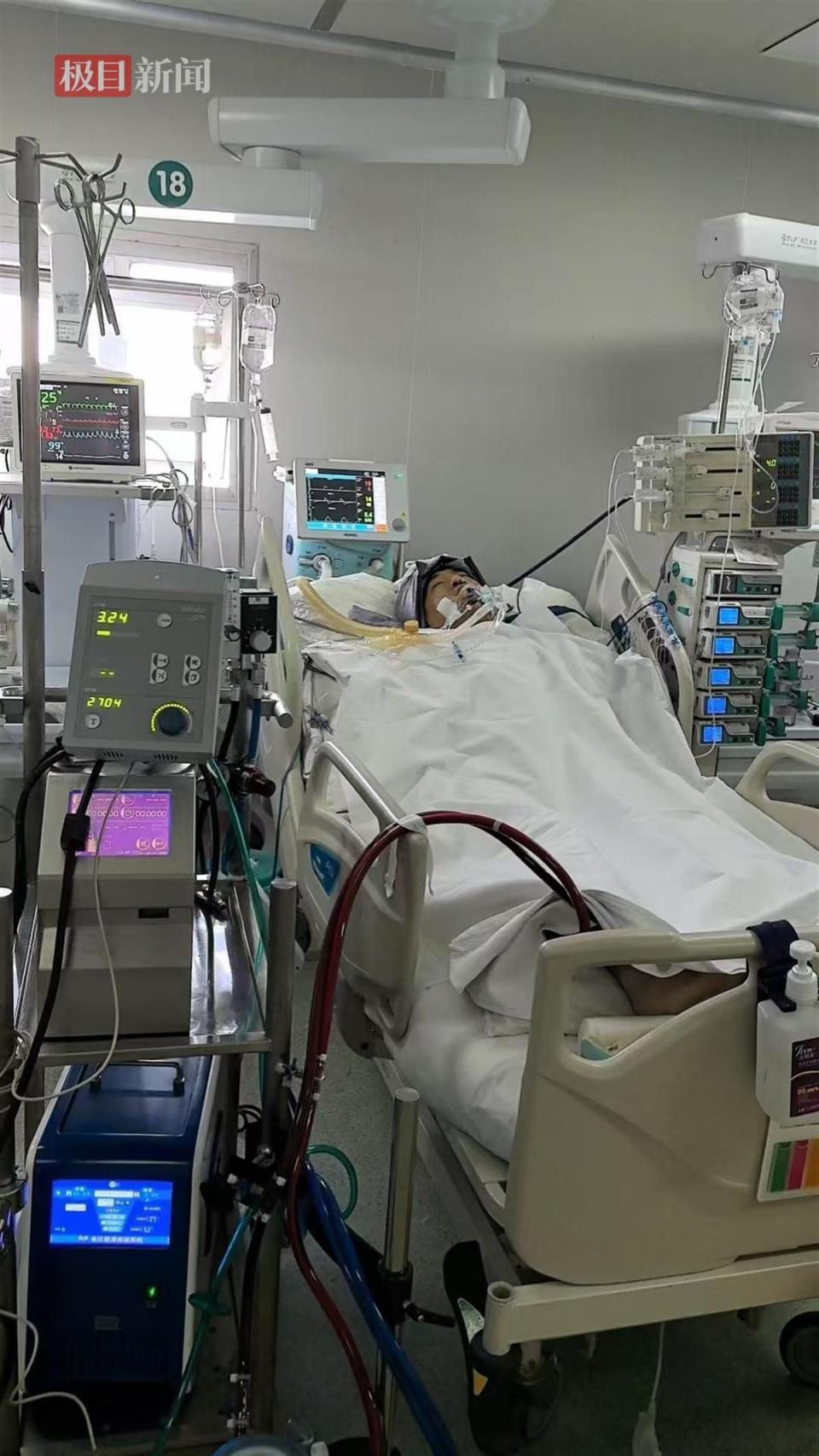 李坤朋发病后,他在2月13日前往了郑州探望,由于李坤朋在重症监护室,他