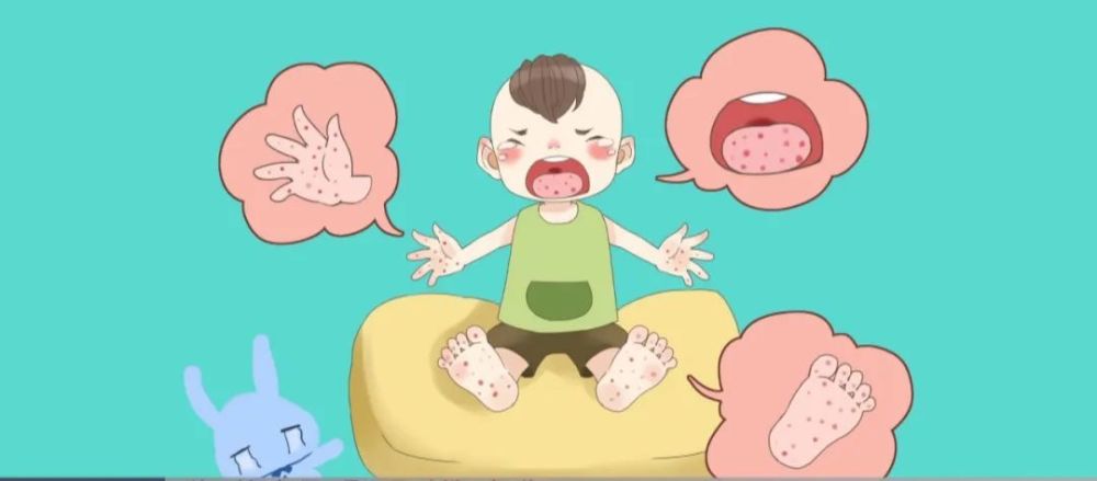 手足口病进入高发期 婴幼儿需做好这3步预防!_腾讯新闻